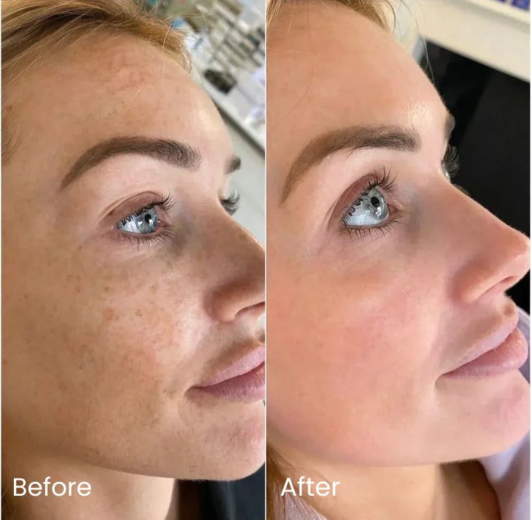 Skin Brightening Toner Pads