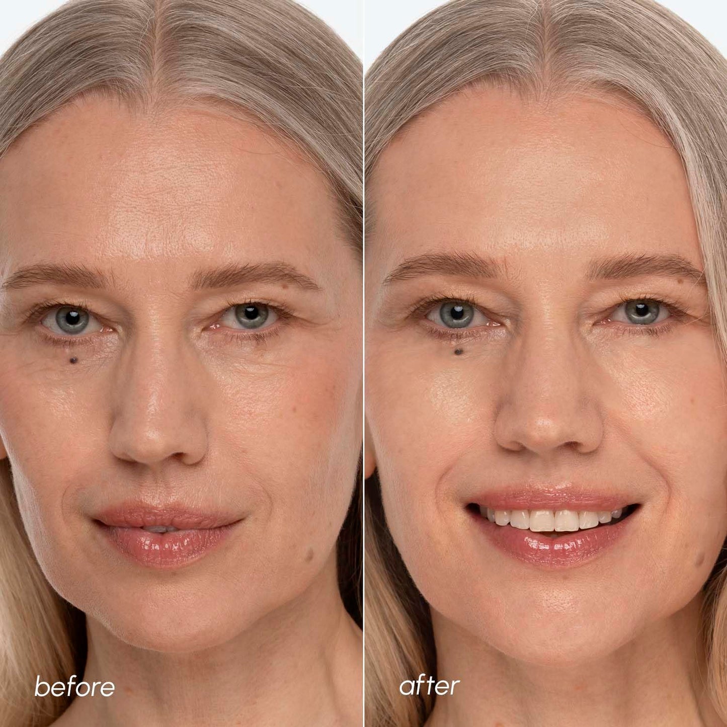 Skin Brightening Toner Pads